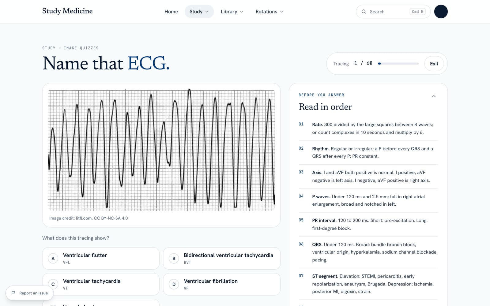The ECG quiz showing a rhythm strip with a read-in-order checklist beside it