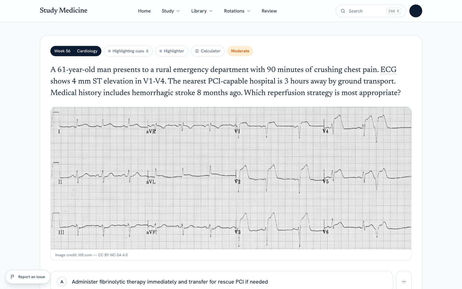 An MCQ about reperfusion for an anterior STEMI, with the 12-lead ECG shown in the question